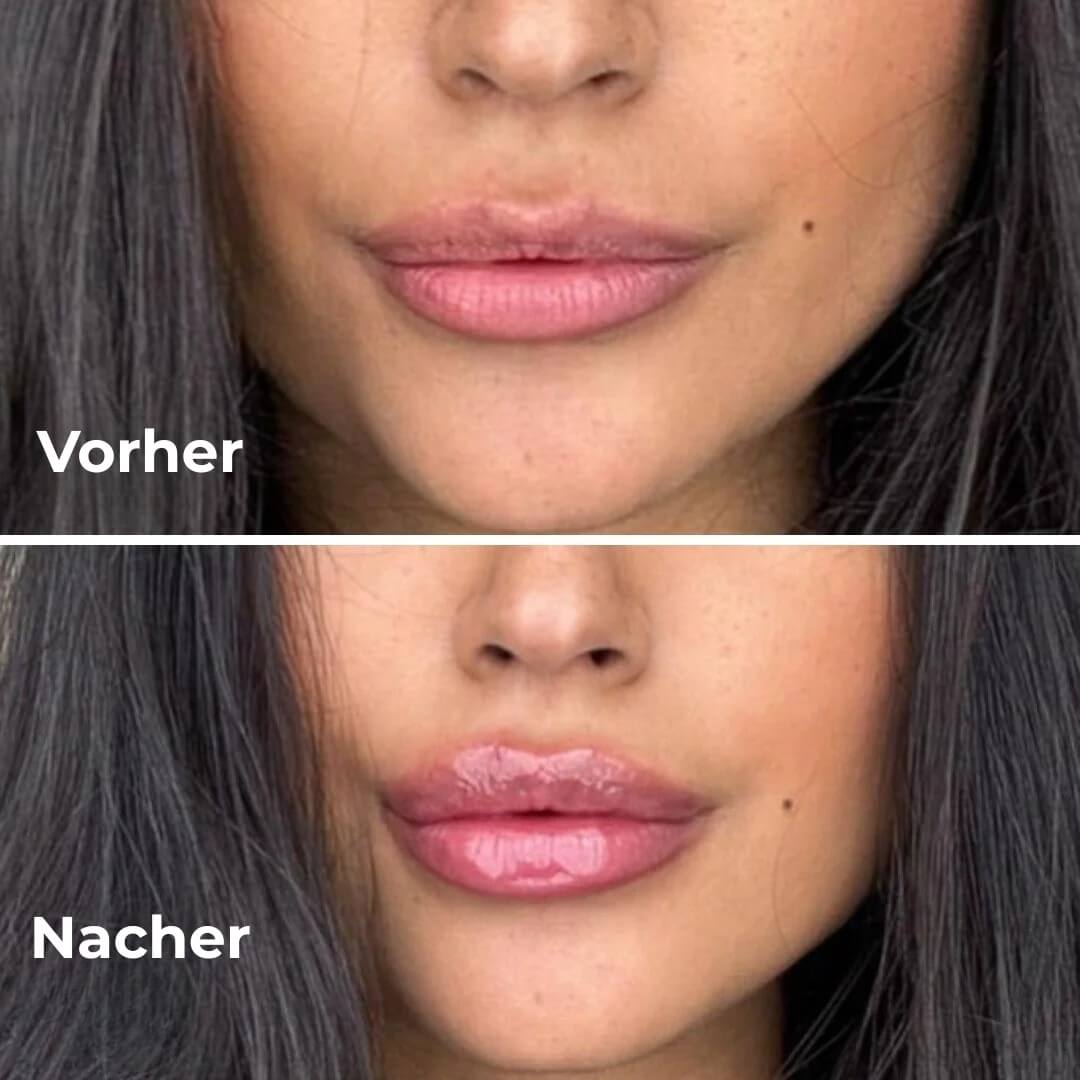 Lifestyle-Foto einer Frau mit aufgetragenem JuicyLips Lip Plumper – sinnlich und natürlich